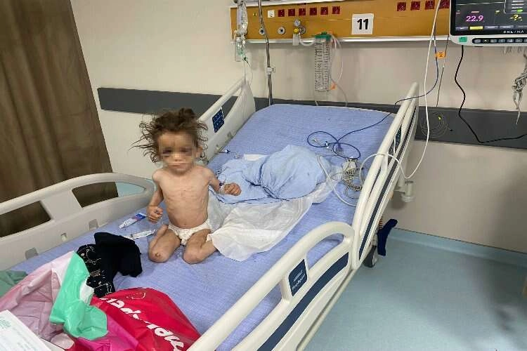 Gaziantep’te anne, 5 yaşındaki çocuğuna günlerce işkence ederek aç bıraktı haberinin görseli