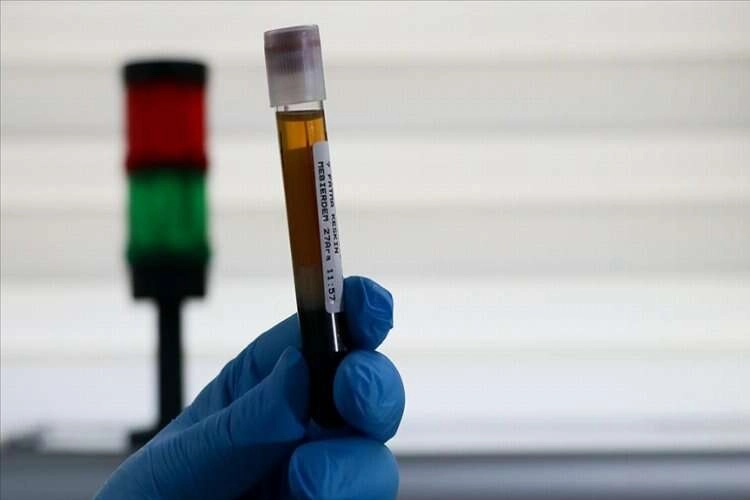 Kök hücre bağışçısı 940 bin kişi genetik ikizini arıyor haberinin görseli