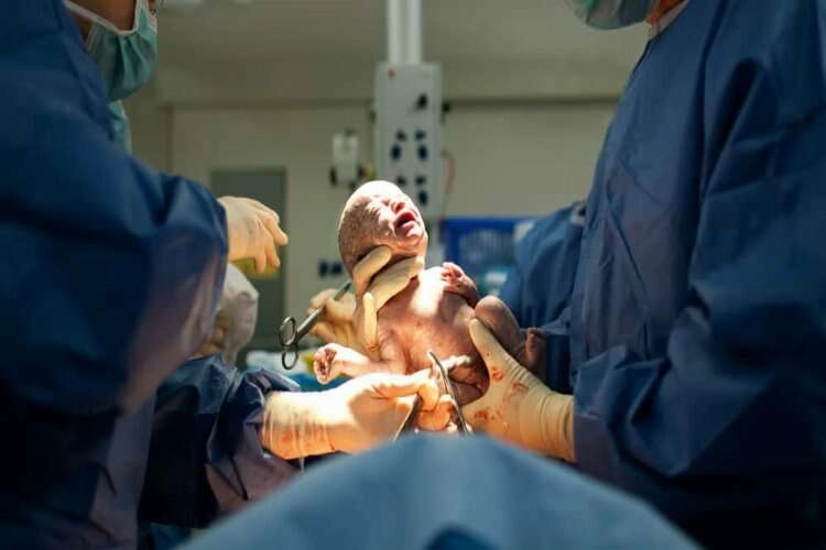Sezaryen doğumlar anne ve bebek sağlığını nasıl etkiliyor? haberinin görseli