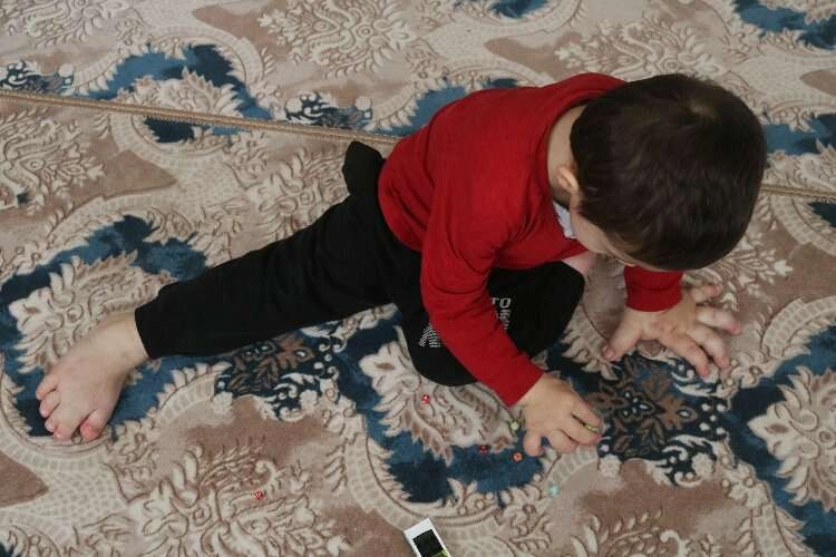 El ve ayakları olması gerekenden 4 kat daha büyük haberinin görseli