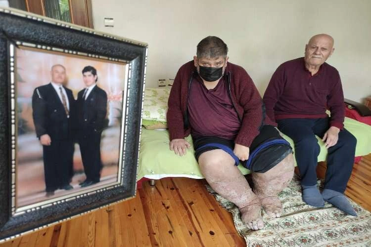 Sivrisinek, hayatını kararttı: 9 yıldır insan içine çıkamıyor haberinin görseli