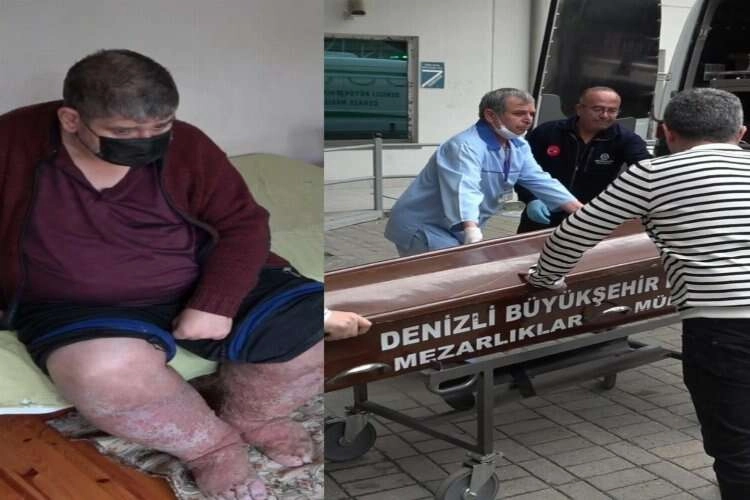 Sivrisinek ısırdı hayata tutunamadı haberinin görseli