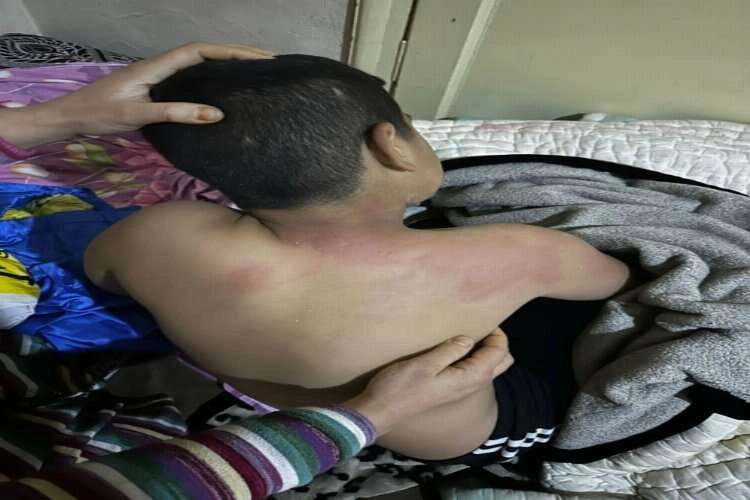 Dehşet veren olay: Suriyeli çocuğa kaynar çay fırlattı haberinin görseli