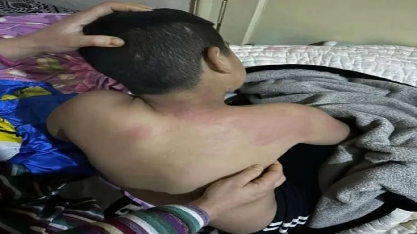 Dehşet veren olay: Suriyeli çocuğa kaynar çay fırlattı haberinin görseli
