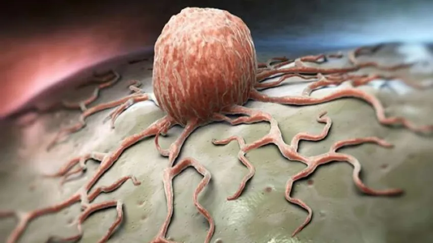 Kansere bağlı ölüm oranlarında düşüş yaşanıyor haberinin görseli