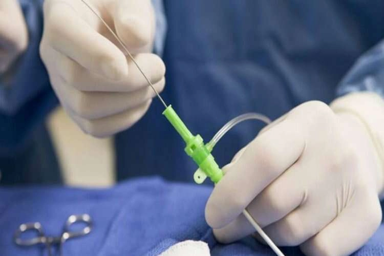 Kalp krizleri anjiyografi ile önlenebilir mi? haberinin görseli