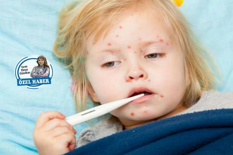 Kızamık vakaları için aşılanma şart haberinin görseli