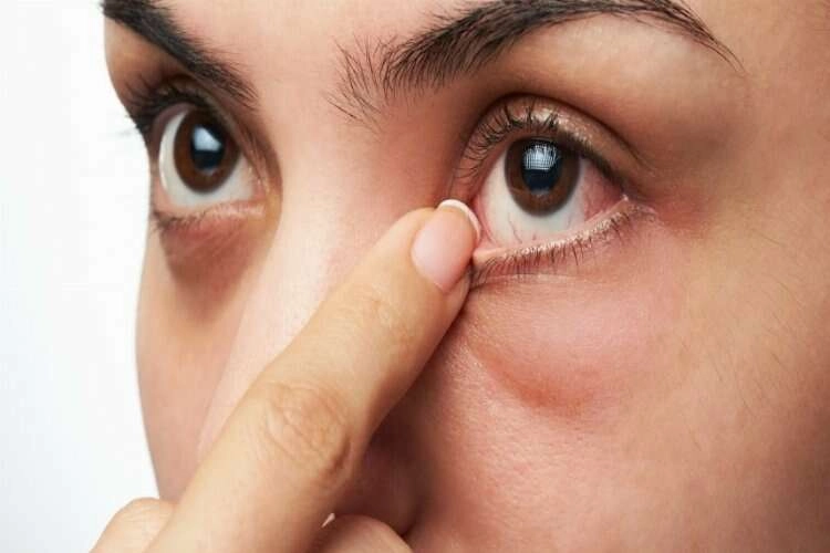Uzmanından gözler için önemli uyarı! haberinin görseli
