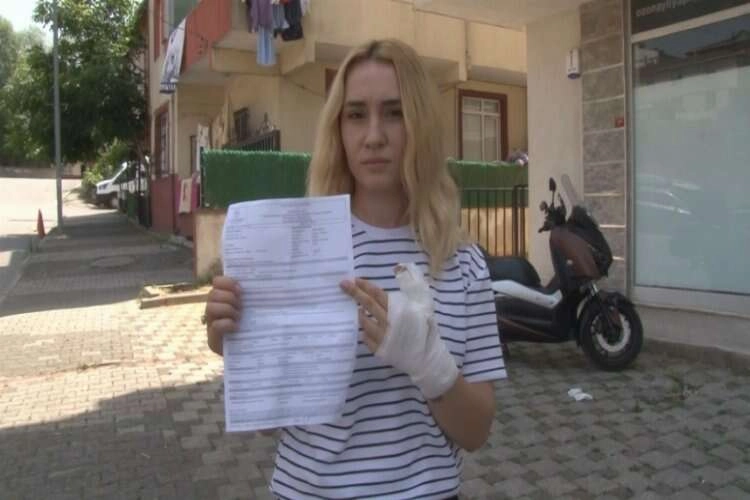 X-Ray krizi: İş arkadaşının parmağını ısırdı haberinin görseli