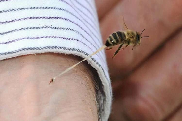 Arı sokmasına iyi gelen şeyler nelerdir? haberinin görseli