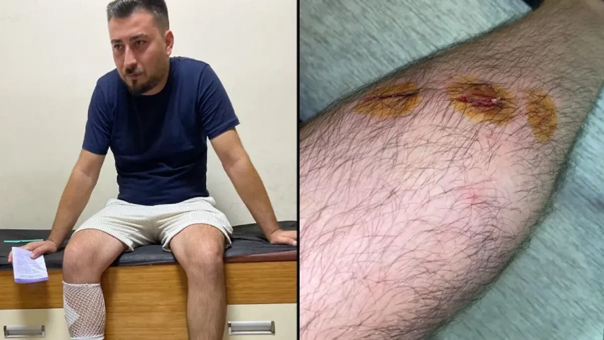 Sokak köpekleri motosikletli gence saldırdı haberinin görseli