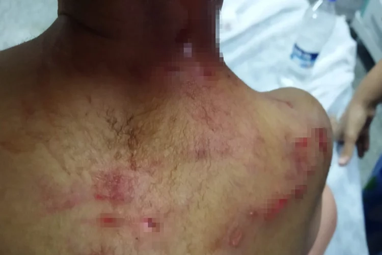 Köpek saldırısına uğrayan çocuk gözlem altına alındı haberinin görseli