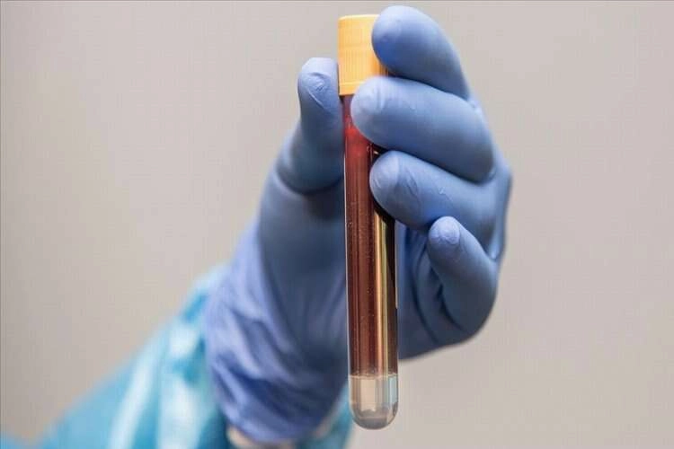 Prostat kanserine karşı yılda bir kez kan testi uyarısı haberinin görseli