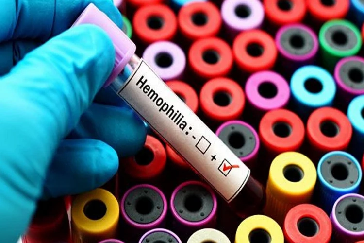 Hemofili nedir? Belirtileri nelerdir? haberinin görseli