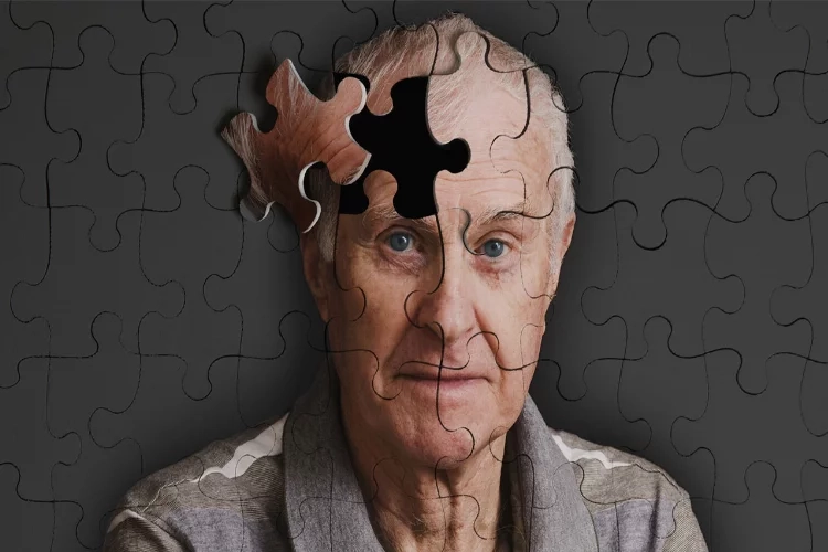Yaşam tarzı Alzheimer riskini artırabilir haberinin görseli