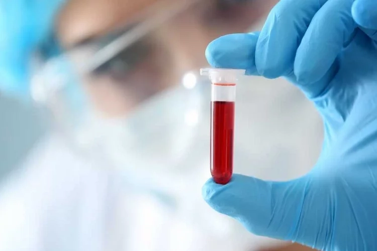 RDW nedir? RDW değerinin yüksek ya da düşük olması tehlikeli midir? haberinin görseli