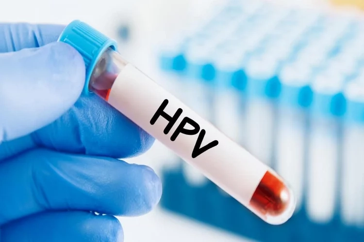 HPV virüsü nedir? HPV belirtileri nelerdir? haberinin görseli