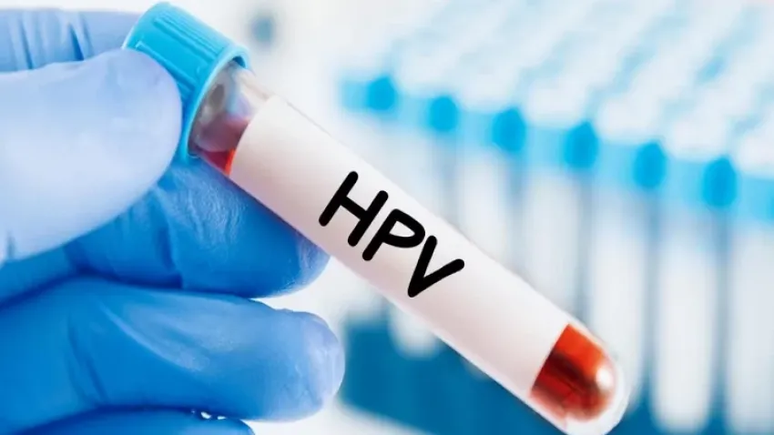 HPV virüsü nedir? HPV belirtileri nelerdir? haberinin görseli