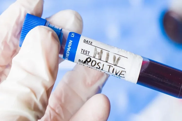 Türkiye’de HIV pozitif hasta sayısı arttı