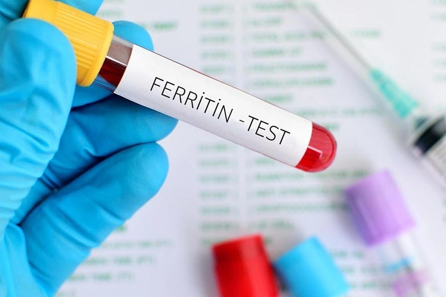 Ferritin nedir? Ferritin kaç olursa tehlikelidir?