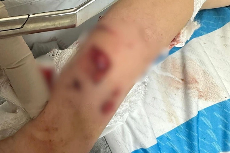 Beslemek isterken saldırıya uğradı haberinin görseli