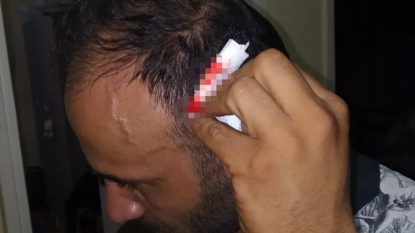 Ev sahibinin oğlu kiracıyı dövdü haberinin görseli