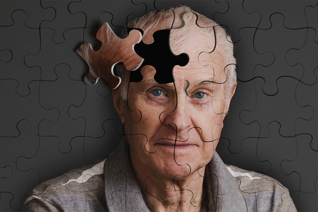 Konuşması bozulan Alzheimer hastaları sosyallikten uzaklaşıyor haberinin görseli