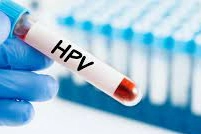 Kadın Hastalıkları Uzmanından HPV uyarısı