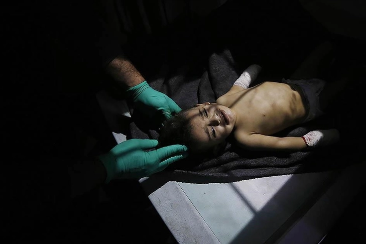 Gazze’de hayatta kalması mücadelesi: Çocuklar aşılarını kaçırma riskiyle karşı karşıya haberinin görseli