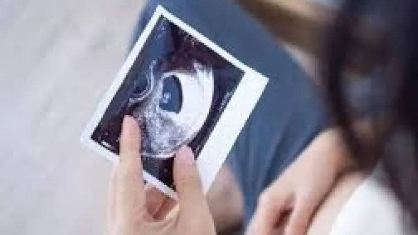 Akraba evliliklerine dikkat! Anomali bebek riski artırıyor haberinin görseli