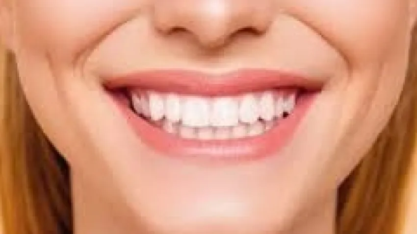 Diş taşının temizlenmemesi diş kaybına yol açabiliyor haberinin görseli