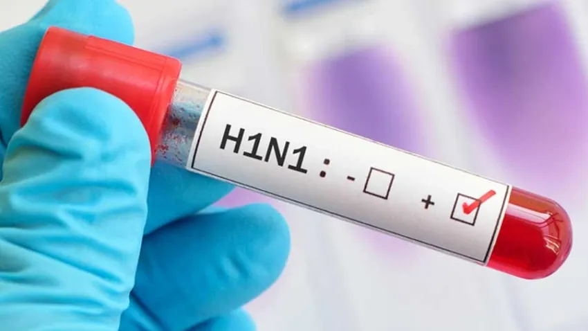 Domuz gribi nedir? Domuz gribi bulaşıcı mı? haberinin görseli