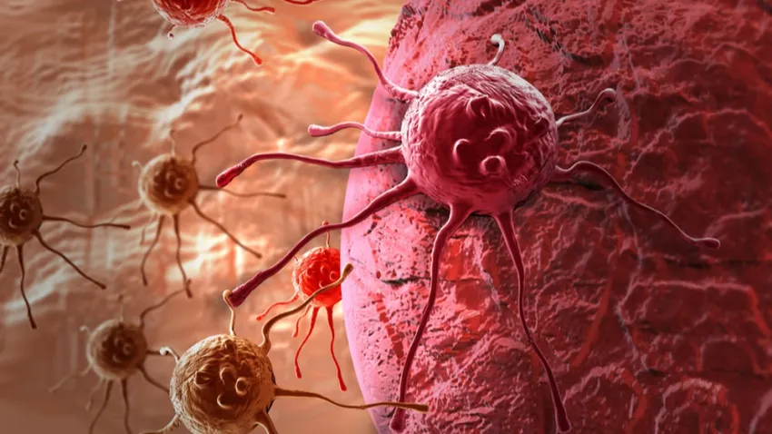 Dünyada en sık görülen kanser türü haberinin görseli