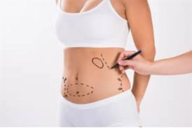 Liposuction diyete alternatif yöntem değildir