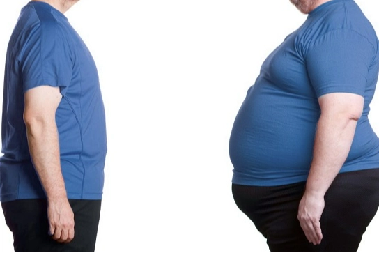 Türkiye’de erkeklerin yüzde 15, kadınların yüzde 25’i obez haberinin görseli