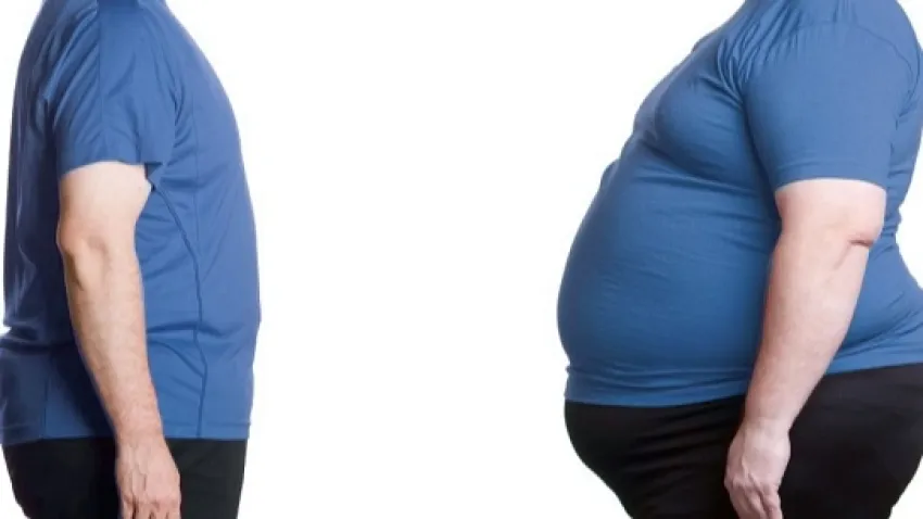 Türkiye’de erkeklerin yüzde 15, kadınların yüzde 25’i obez haberinin görseli