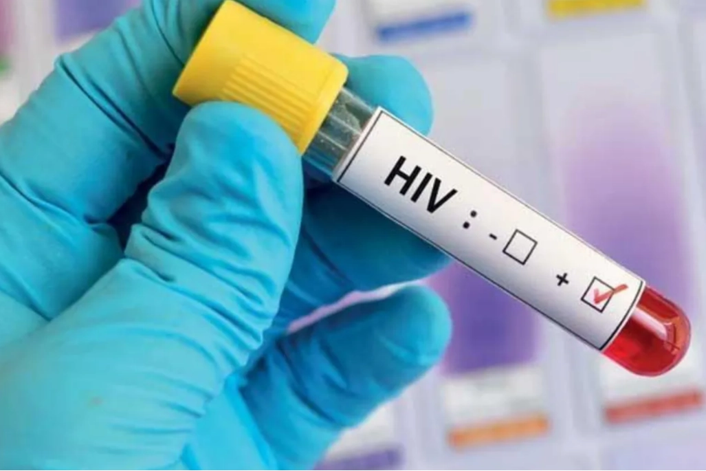 HIV virüsü nedir, belirtileri nelerdir? HIV virüsü nasıl bulaşır?