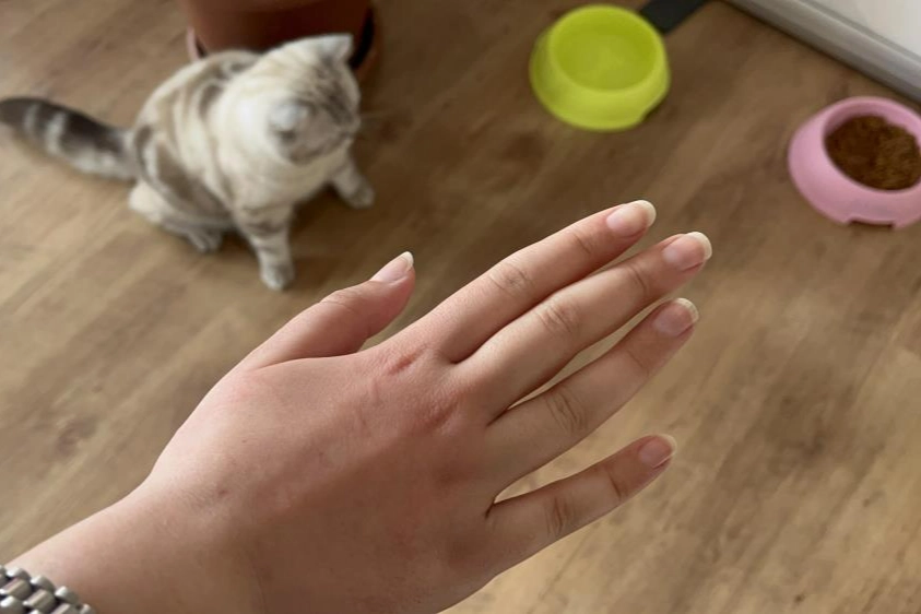 Uzmanı uyardı: Kedi tırmalamasına dikkat! haberinin görseli