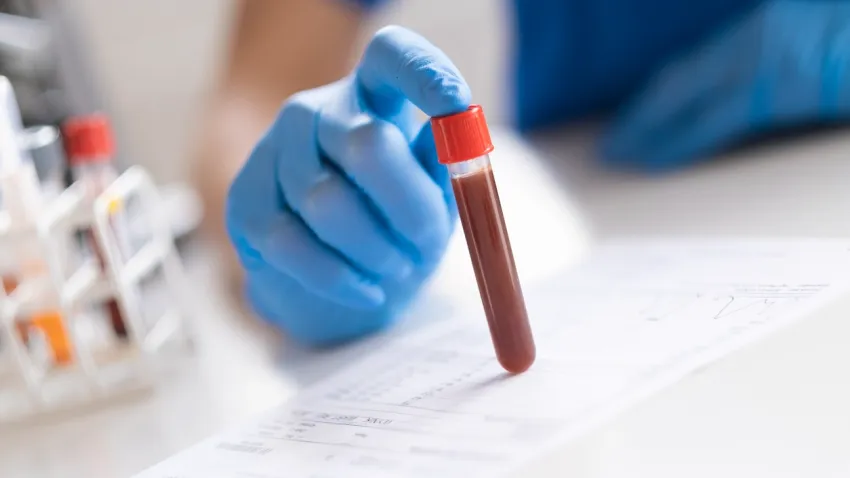 PDW nedir? PDW yüksekliği ve düşüklüğü ne anlama gelir? haberinin görseli