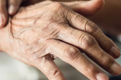 Koku kaybı ve kabızlığa dikkat: Parkinson habercisi olabilir