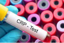 Ebeveynlerin korkulu rüyası CRP'de doğru bilinen yanlışlar haberinin görseli