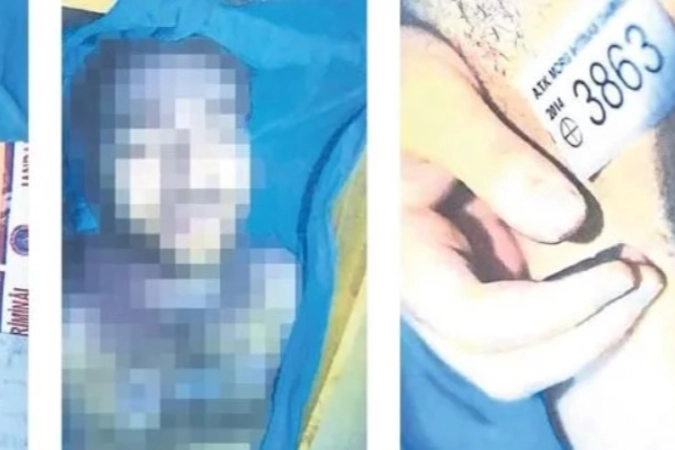 Cem Garipoğlu’nun otopsi görüntüleri ortaya çıktı! haberinin görseli