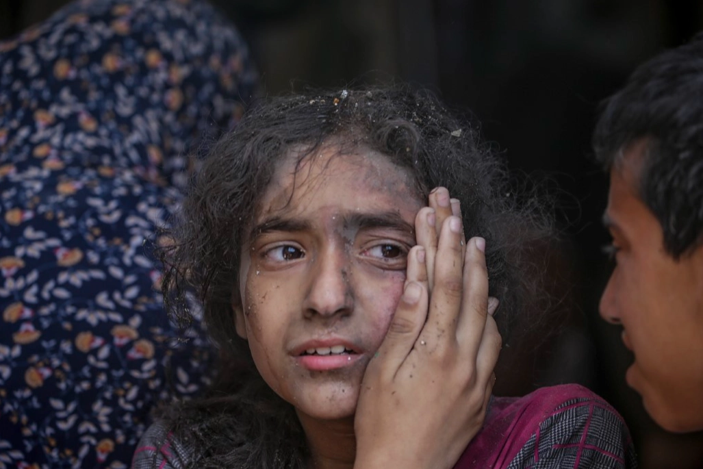 İsrail'in Gazze'deki saldırıları devam ediyor: Gazze Şeridi’nde hayatını kaybedenlerin sayısı 34 bin 683’e yükseldi haberinin görseli