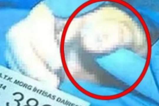 Cem Garipoğlu’nun elindeki mor lekelerin sırrı!