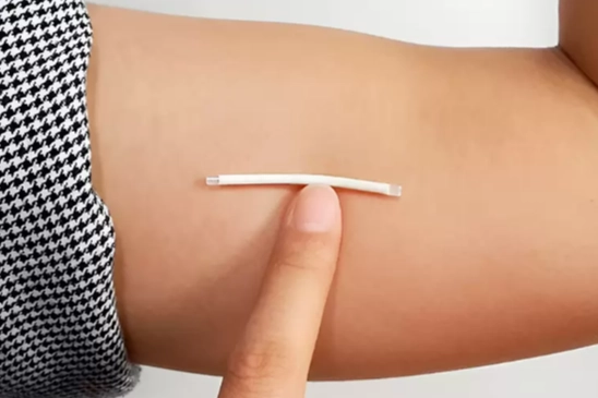 Deri altı implant nedir? Deri altı implantı kimlere takılır?