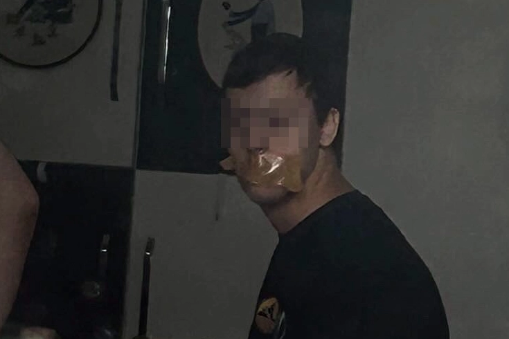 Down sendromlu öğrencinin ağzı bantlandı! haberinin görseli