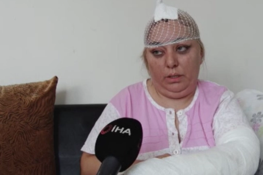 Kiracısını demir sopayla döven ev sahibi tutuklandı! haberinin görseli