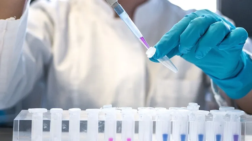 HIV pozitif olduğunu saklayan eş kasten öldürmeye teşebbüsten yargılanıyor haberinin görseli