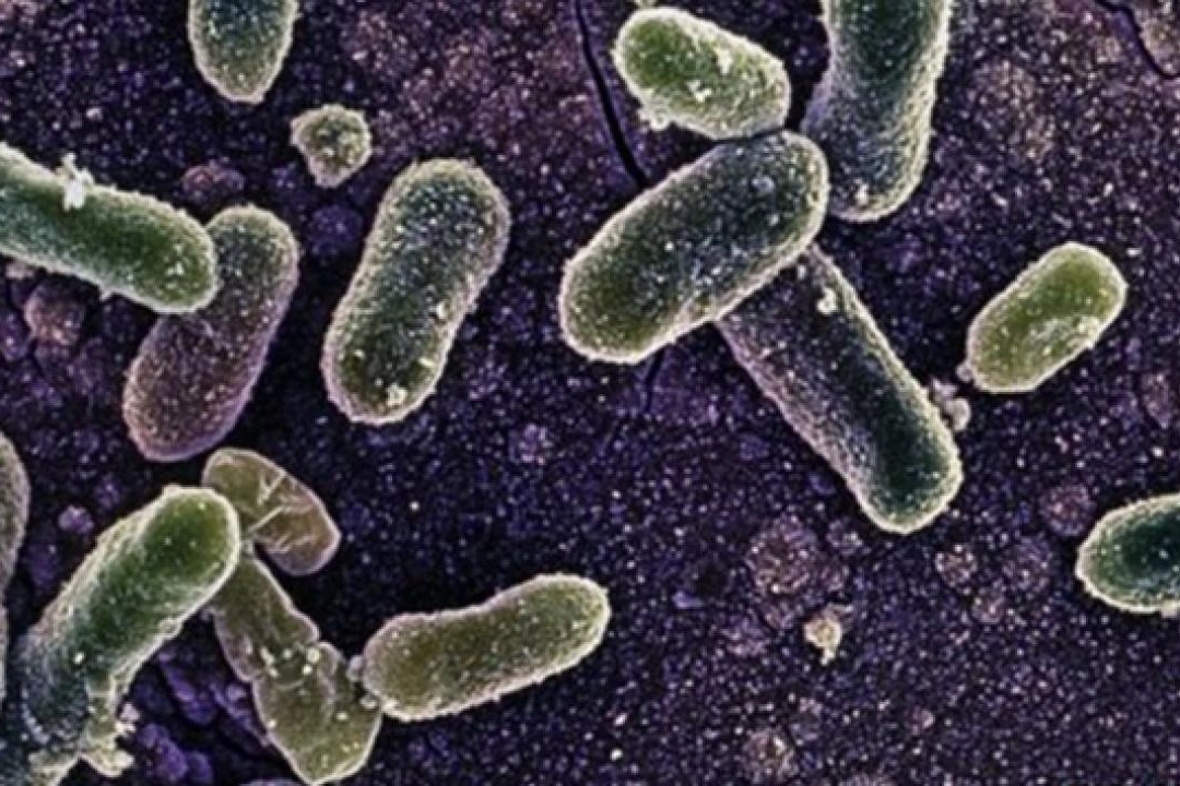 Salmonella virüsü nedir, belirtileri neler? Salmonella virüsü öldürür mü?