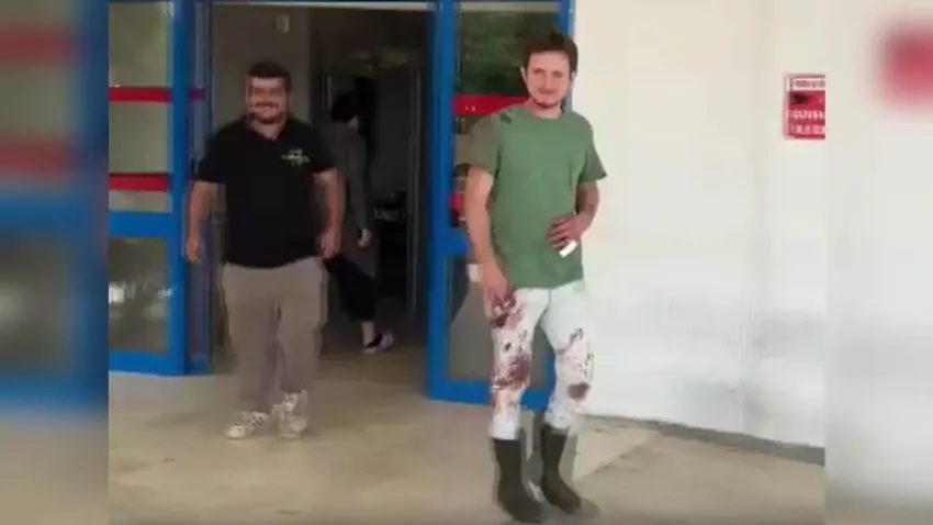 Acemi kasaplar hastaneleri doldurdu haberinin görseli